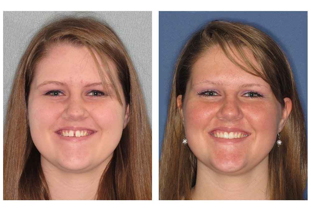 Elmwood Park Cosmetic Dentistry